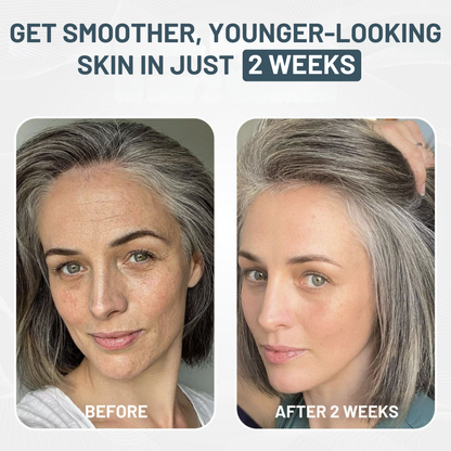 Miaxa™ Micro-Infusion Kit – Anti-Ageing Solution