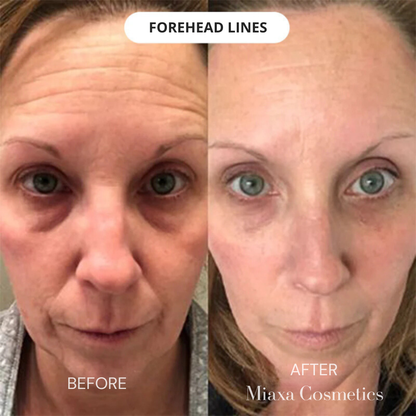 Miaxa™ Micro-Infusion Kit – Anti-Ageing Solution