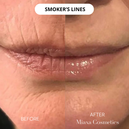 Miaxa™ Micro-Infusion Kit – Anti-Ageing Solution