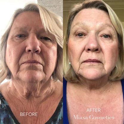 Miaxa™ Micro-Infusion Kit – Anti-Ageing Solution